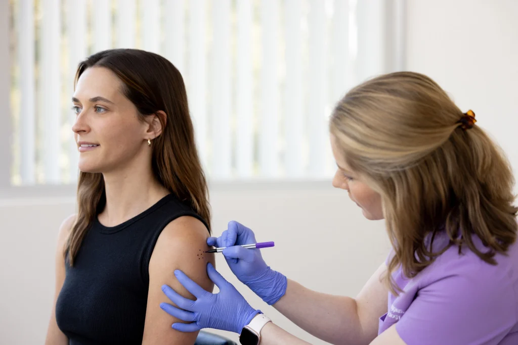 Dr Kappius using a surgical marker to outline a skin lesion on a patient's shoulder before a procedure.